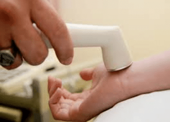 Cavitation During Low-Frequency Sonophoresis