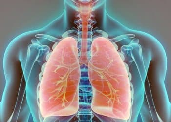 BHO-related Lung Injury